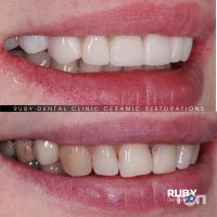 Ruby Dental Clinic, стоматологічна клініка Кухаревича Олексія Віталійовича - фото 8