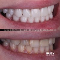 Ruby Dental Clinic Рівне фото