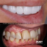 відгуки про Ruby Dental Clinic фото