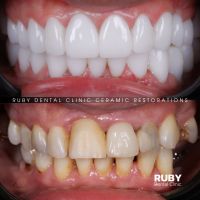 Стоматології Ruby Dental Clinic фото