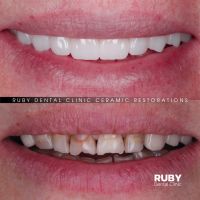 Ruby Dental Clinic відгуки фото