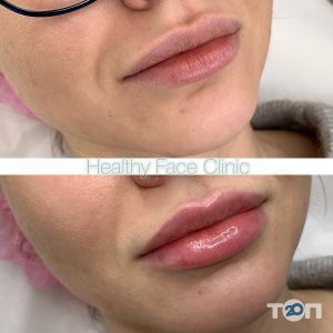 Healthy Face Clinic, клиника здоровой красоты