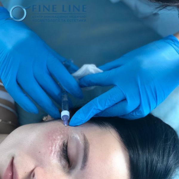 Лазерная эпиляция в Ивано-Франковске: ТОП лучших компаний