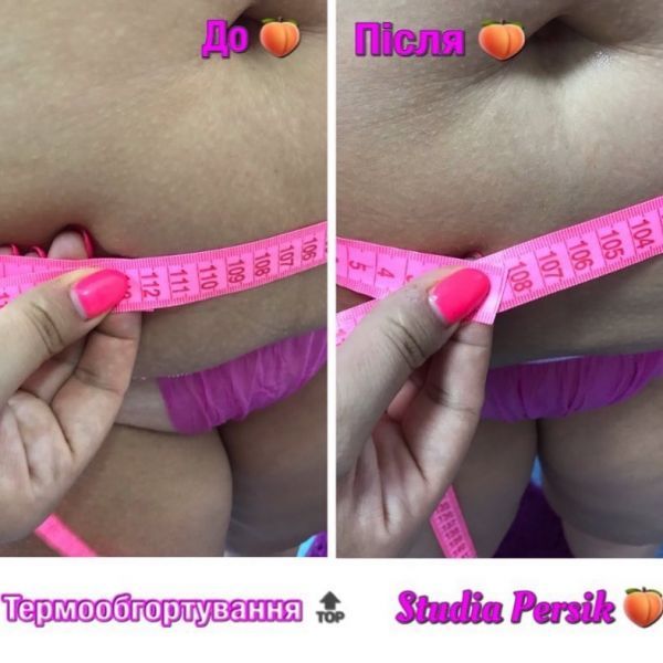 Обзор компаний, что предлагают услуги похудения в г. Черкассы