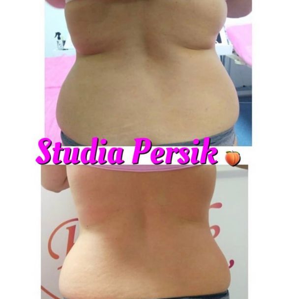 Обзор компаний, что предлагают услуги похудения в г. Черкассы