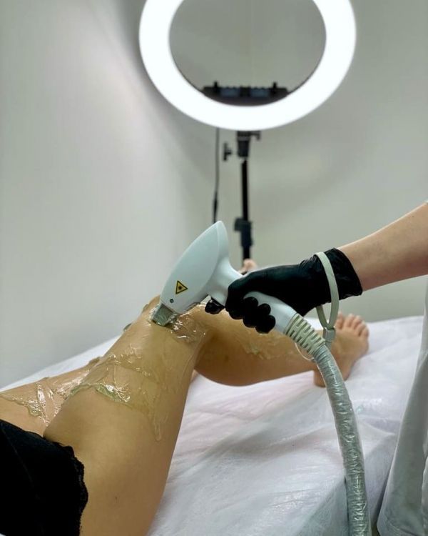 Лазерная эпиляция в Черкассах: обзор компаний для безупречной гладкости