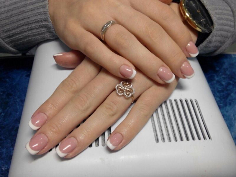 Лазерная эпиляция в Черкассах: обзор компаний для безупречной гладкости