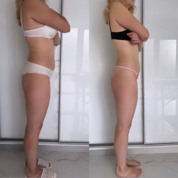 Обзор компаний, что предлагают услуги похудения в г. Ивано-Франковск