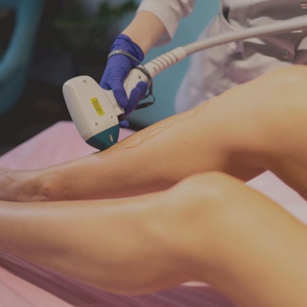 Лазерная эпиляция в Луцке: обзор компаний для безупречной гладкости