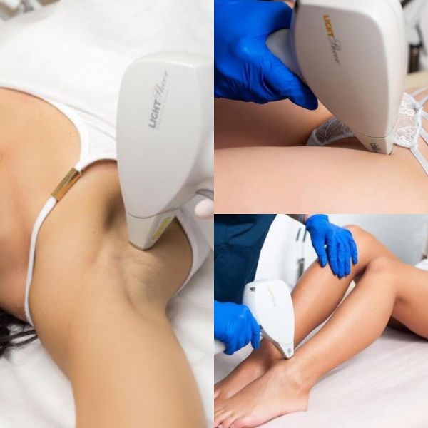 Лазерная эпиляция в Черкассах: обзор компаний для безупречной гладкости