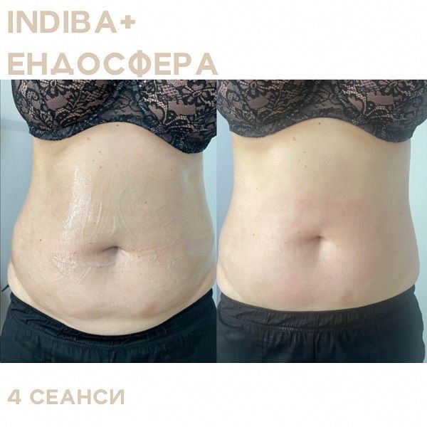 Обзор компаний, что предлагают услуги похудения в г. Днепр