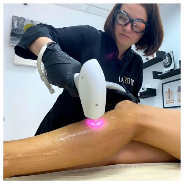 Лазерная эпиляция в Чернигове: топ компаний города