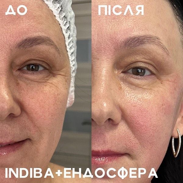 Обзор компаний, что предлагают услуги похудения в г. Днепр