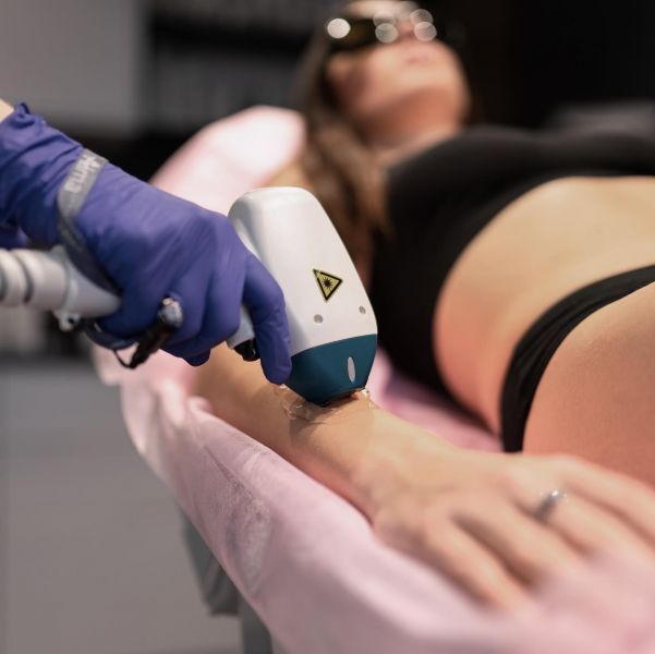 Лазерная эпиляция в Ивано-Франковске: ТОП лучших компаний