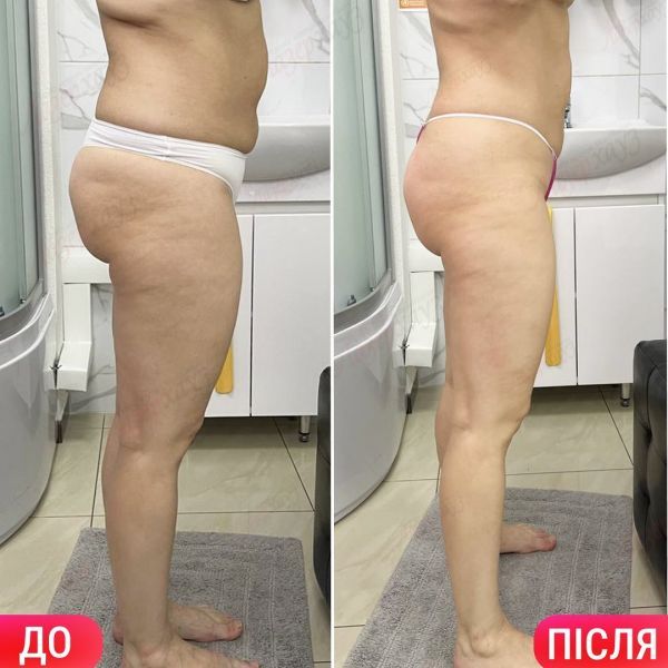 Обзор компаний, что предлагают услуги похудения в г. Одесса