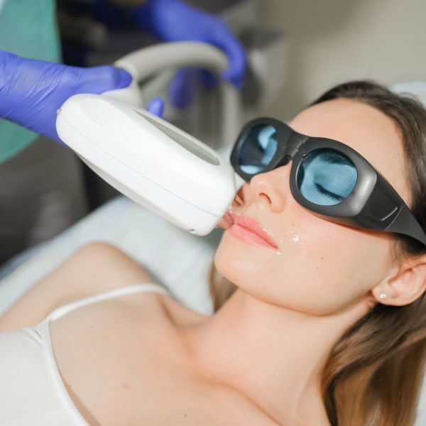 Полный обзор услуг лазерной эпиляции в Полтаве