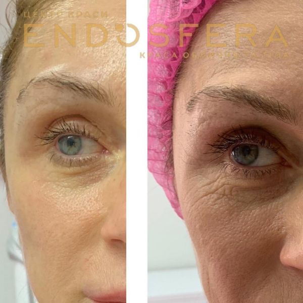 Обзор компаний, что предлагают услуги похудения в Черновцах