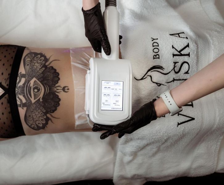 Обзор компаний, что предлагают услуги похудения в г. Луцк