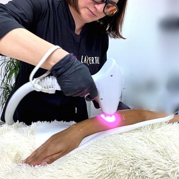 Лазерная эпиляция в Чернигове: топ компаний города