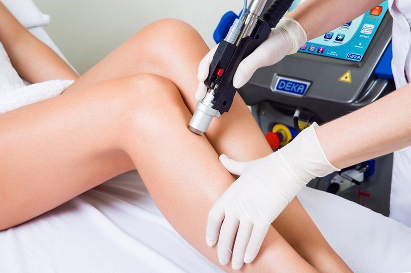 Лазерная эпиляция в Одессе: Рейтинг самых популярных компаний