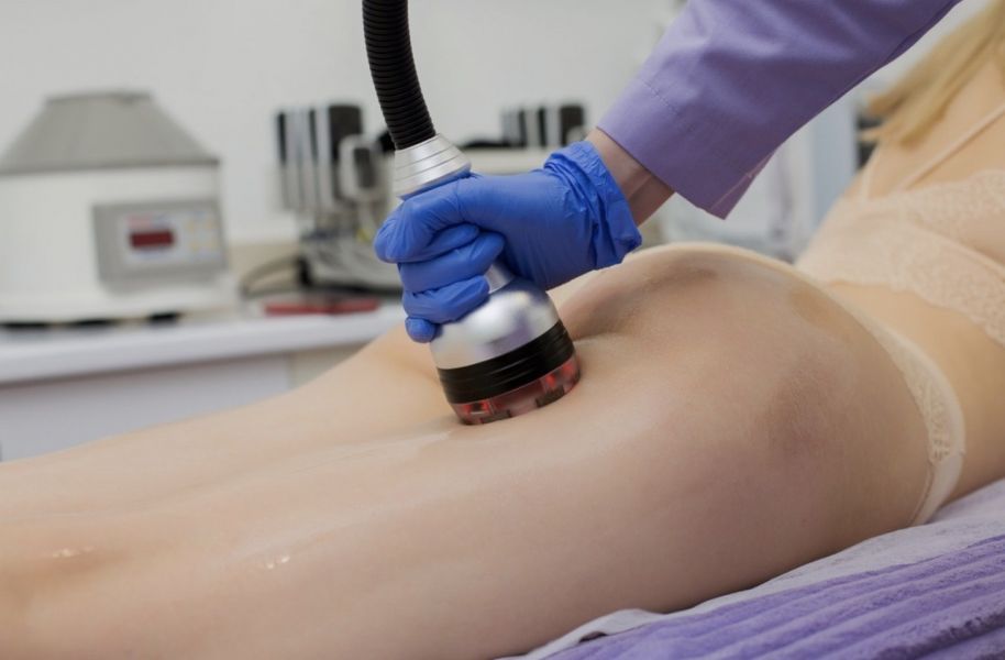 Лазерная эпиляция в Ужгороде: список популярных компаний