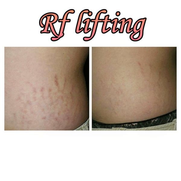 Обзор компаний, что предлагают услуги похудения в г. Черкассы