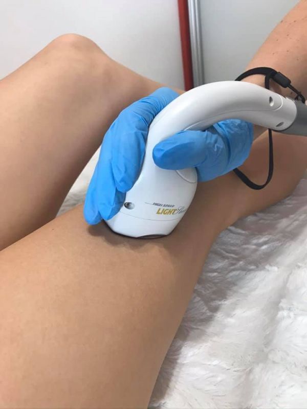 Лазерная эпиляция в Сумах: список лучших компаний города