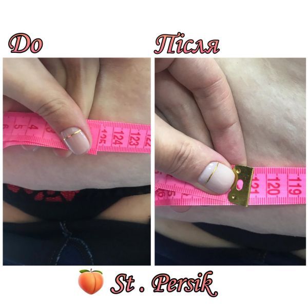 Обзор компаний, что предлагают услуги похудения в г. Черкассы