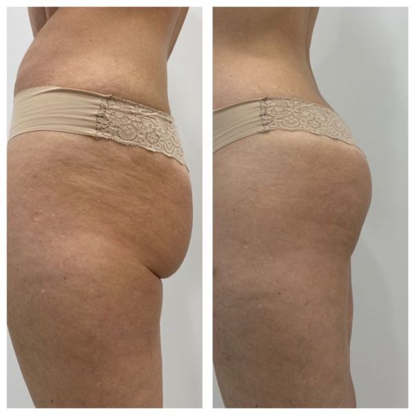 Обзор компаний, что предлагают услуги похудения в г. Днепр