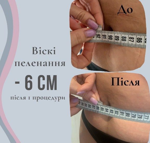 Обзор компаний, что предлагают услуги похудения в г. Ивано-Франковск