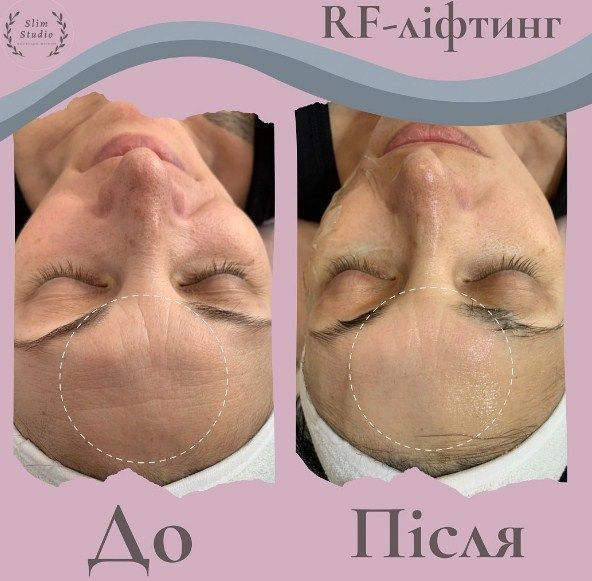 Обзор компаний, что предлагают услуги похудения в г. Ивано-Франковск