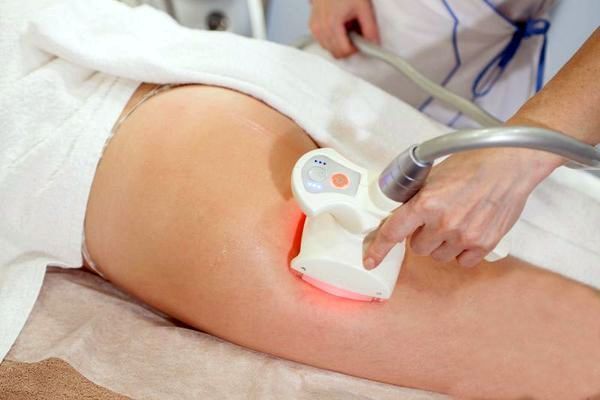 Обзор компаний, что предлагают услуги похудения в г. Днепр